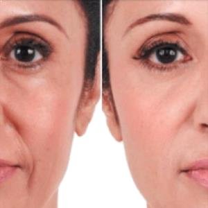 Beautiful Image of a rectangle