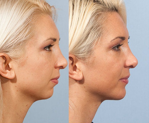 Beautiful Image of a rectangle